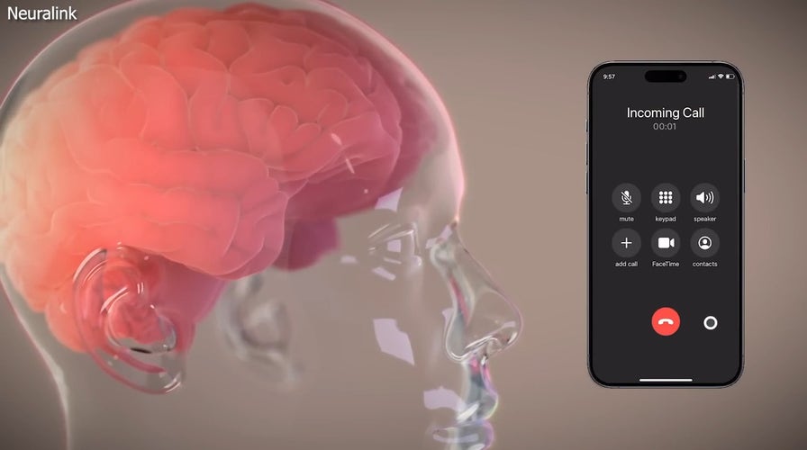 Elon Musk's brain chip startup Neuralink has successfully implanted a device in a human patient