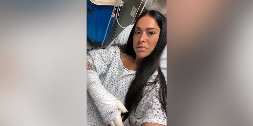 LA reporter burned after portable charger explodes