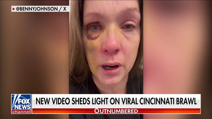 Cincinnati beating victim speaks out after brutal attack: Still recovering