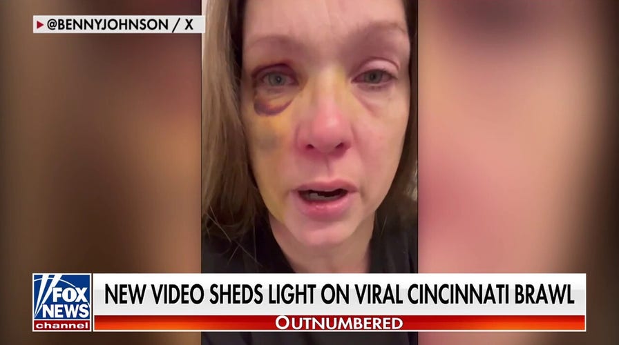 Cincinnati beating victim speaks out after brutal attack: Still recovering