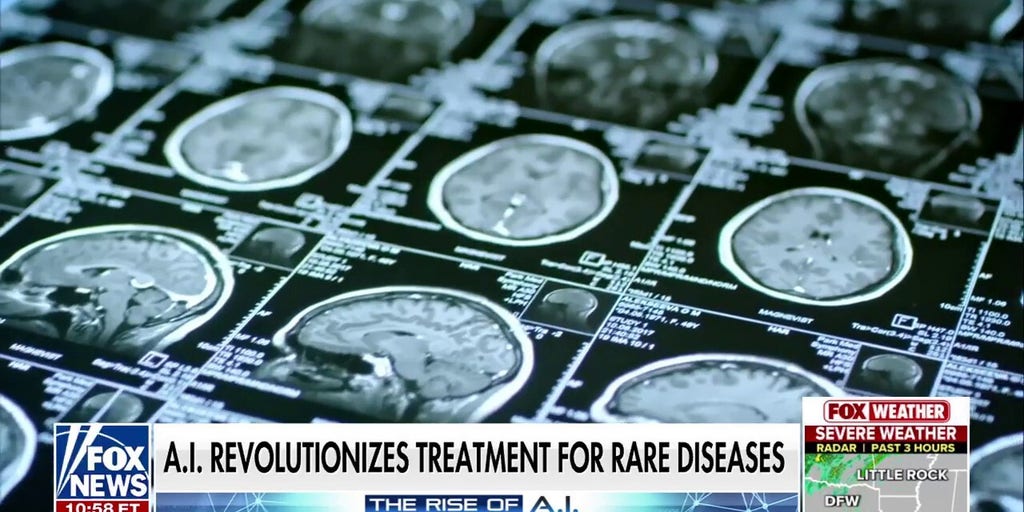 Washington resident credits AI treatment for saving his life