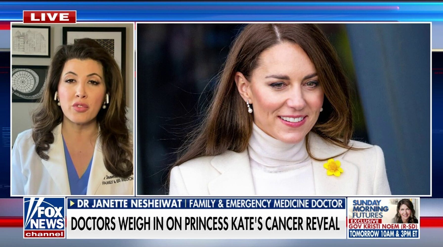 Princess Kate's Cancer Battle: A Reminder of the Importance of Cancer Screening