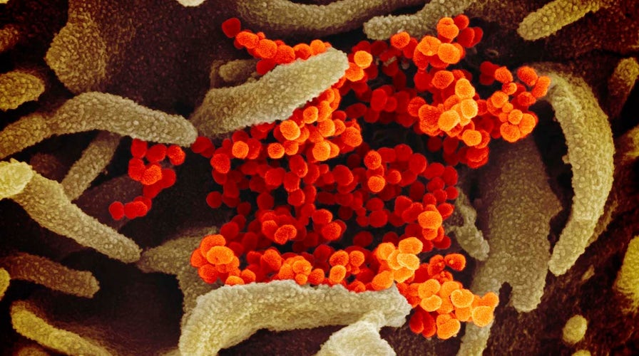 Northern California Has 1st Coronavirus Case Of Unknown Origin Cdc Northern California Has 1st Coronavirus Case Of Unknown Origin Cdc