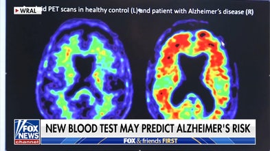 New blood test may predict Alzheimer's risk