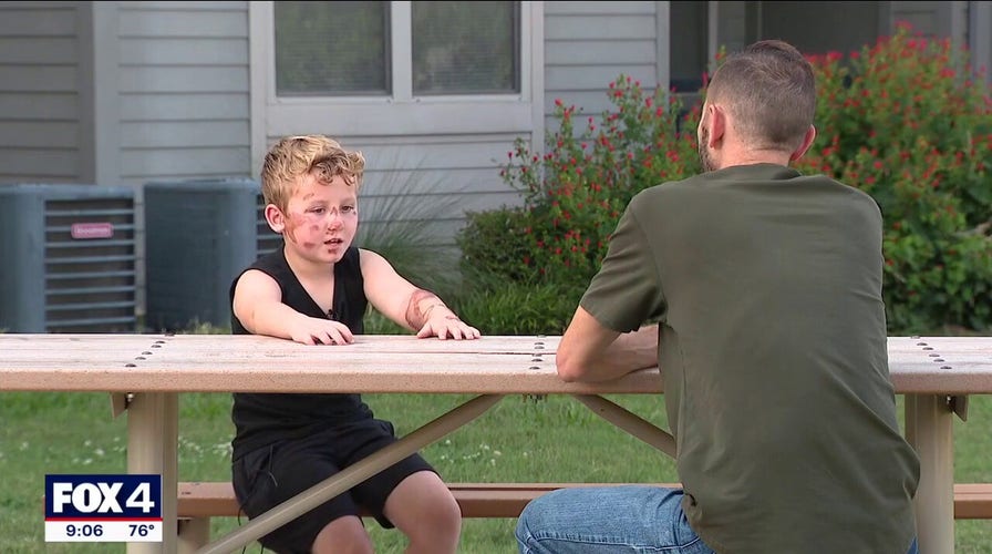 8-year-old boy speaks out following Fort Worth hit-and-run
