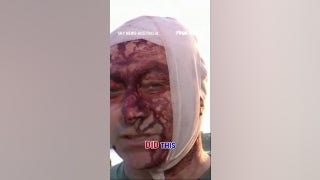 WATCH: Survivor of Oct 7 narrowly escapes Australia terror attack