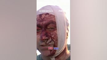 WATCH: Survivor of Oct 7 narrowly escapes Australia terror attack