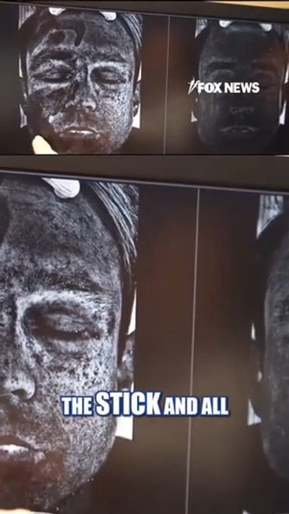Adam Klotz learns to properly apply sunscreen using UV camera