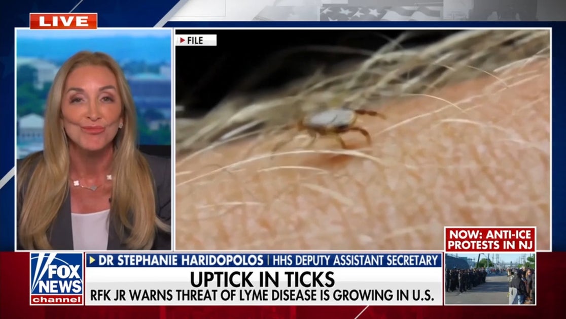 HHS official confronts Alpha-gal, Lyme disease cases