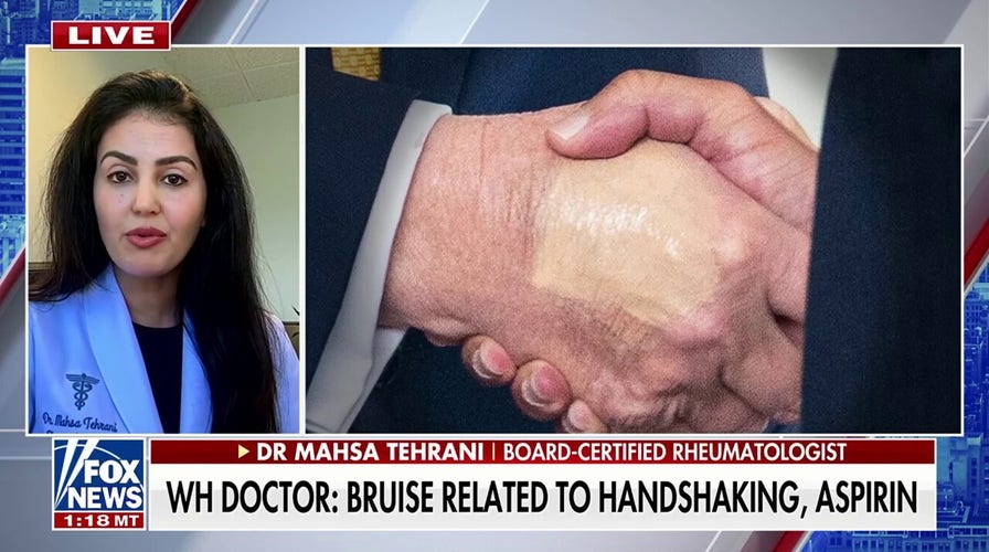 ‘McDonald’s has to go,’ says rheumatologist after President Trump’s Chronic Venous Insufficiency diagnosis