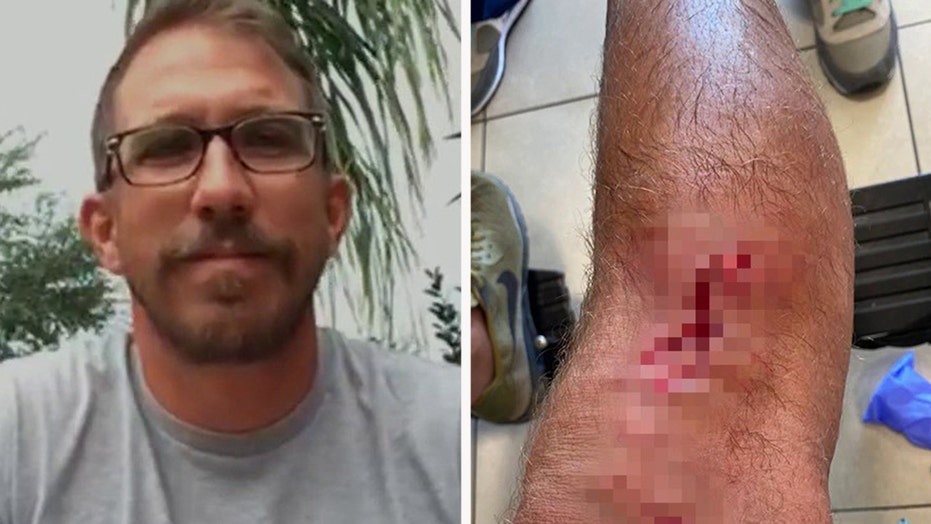 Alligator attack survivor bitten by shark in Florida