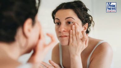 What your dark under-eye circles could be telling you about your health