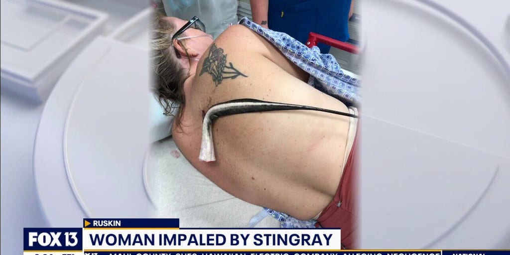 Florida woman impaled in back by stingray | Fox News Video