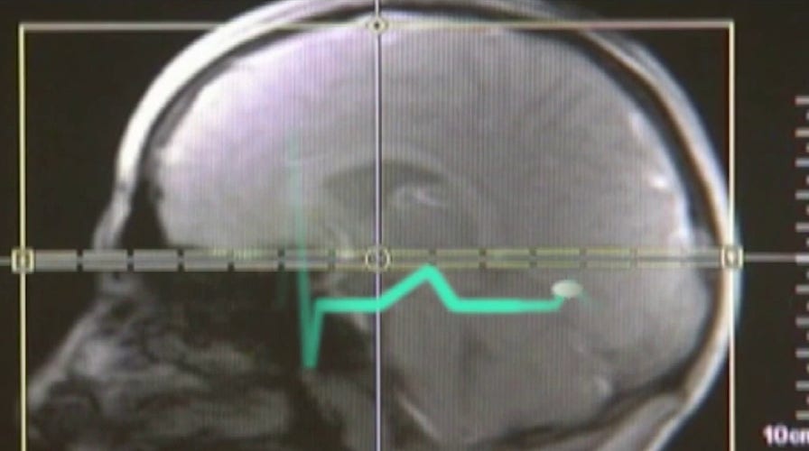 Officials say 130 suspected victims of possible energy weapon