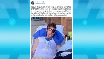 Benjamin Hall tweets about recovery and wounds he suffered in Ukraine