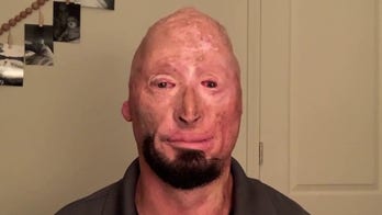 Wounded veteran tells Democrats to stop using him as a prop