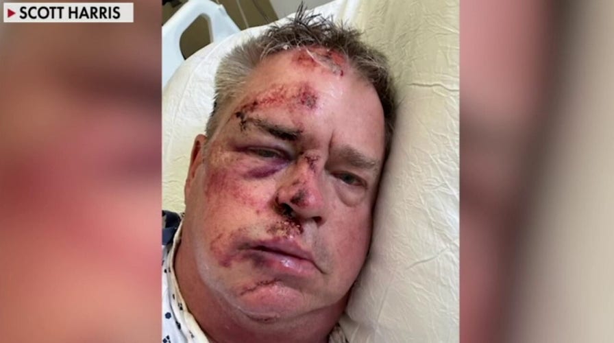 Navy vet brutally mugged in Philadelphia while walking his dog, gets 100 stitches