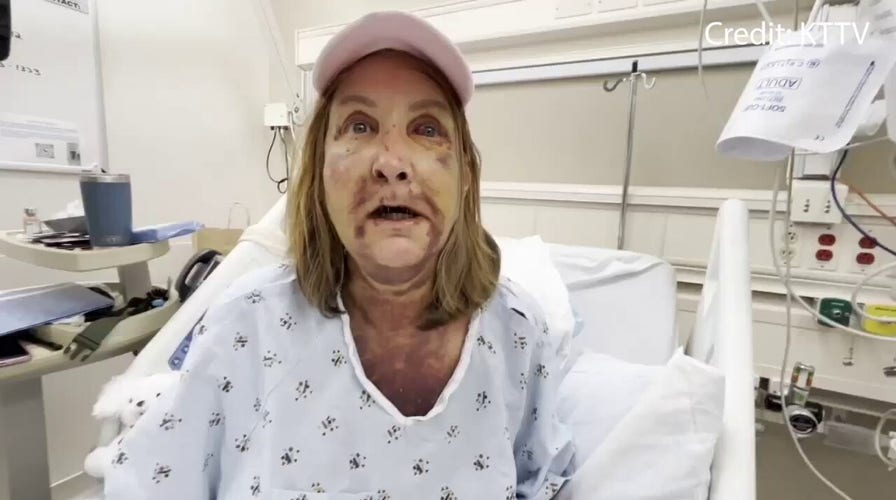 Los Angeles attack victim reacts to suspect's arrest
