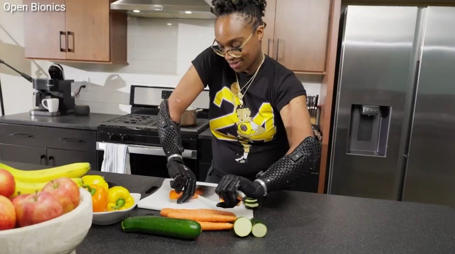 'CyberGuy': Wireless, waterproof bionic arm with 360-degree wrist rotation, lightning-fast control