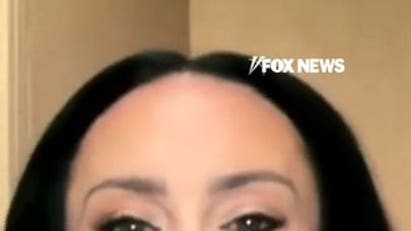 Dr Gabrielle Lyon reveals signs of abnormal hair loss