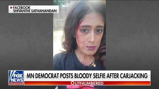 Minnesota Democrat changes tune on 'Defund the police' movement after brutal assault - Fox News