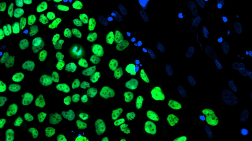 Embryonic stem cells_Reuters.jpg