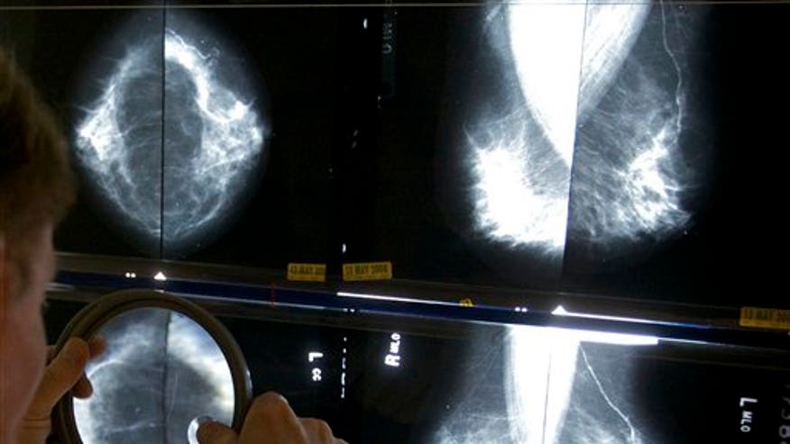 mammograms_breast_cancer_ap.jpg