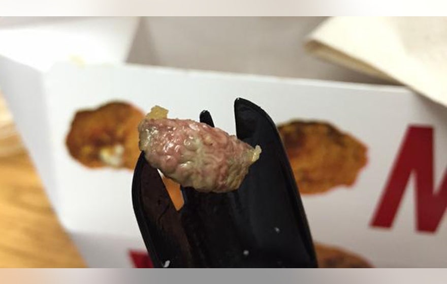 Stockton Auto World >> Teen finds chicken organ in KFC lunch | Fox News Stockton Auto World >> Teen finds chicken organ in KFC lunch | Fox News