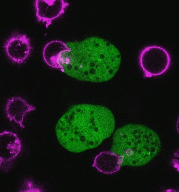 Parasitic amoeba chomps on human cells to kill them | Fox News