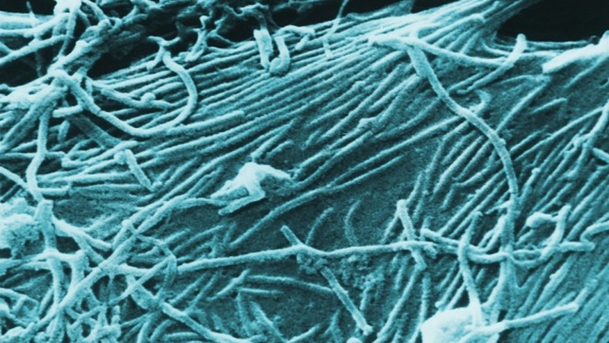 Ebola-virus-electron.jpg