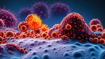 AI spots pancreatic cancer up to 16 months before doctors, surgeon says