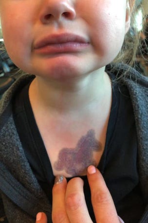 Toddler gets painful surprise at airport