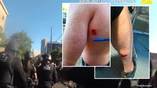 New video shows attacks on Seattle police, graphic images of officer injuries