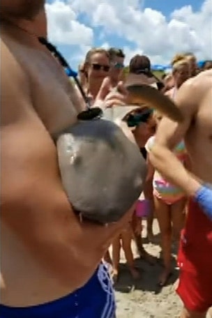 Guy acts like SHARK BITE is no big deal