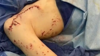 Miami faces more problems as one boy experiences a terrifying beach encounter