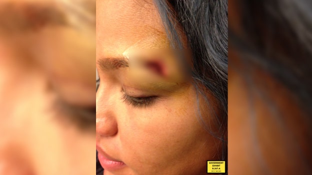 Cassie Ventura injury photos submitted as government evidence in federal trial