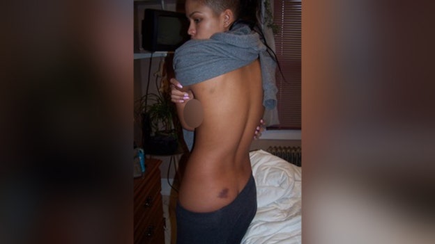 Cassie's mom 'memorialized' bruises allegedly given by Diddy with photos