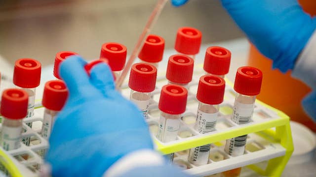 Henry Schein brings new coronavirus testing to market