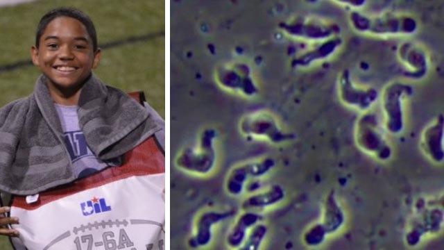 Fourteen-year-old dies of brain-eating amoeba infection