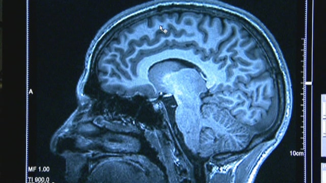 New study suggests Alzheimer's may be transmitted in surgery