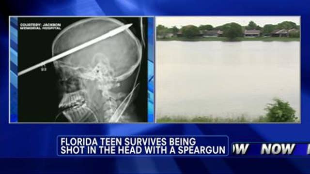 Incredible Story Florida Teen Survives Being Shot In The Head With A Speargun Latest News