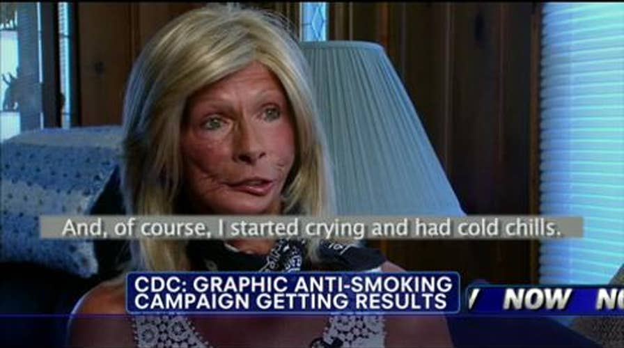 Ex-Smoker Speaks Out About Graphic Ads