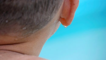 How to treat swimmer's ear