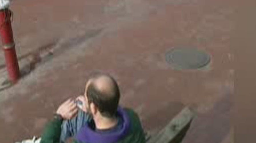 Bald Men at Greater Heart Disease Risk