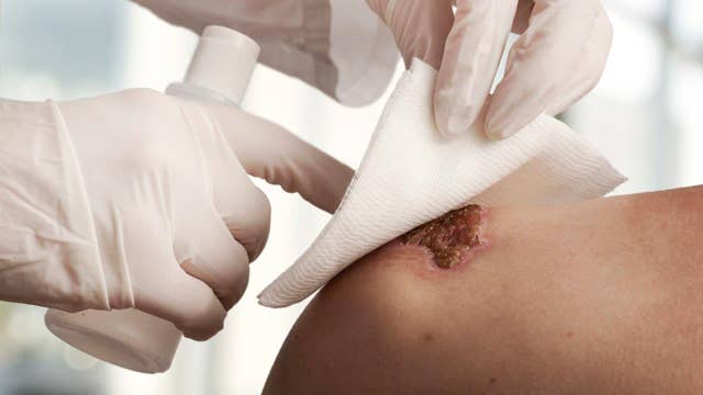 Human membrane could revolutionize wound treatment