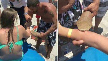 Woman bitten by shark admitted to hospital with shark still attached to arm