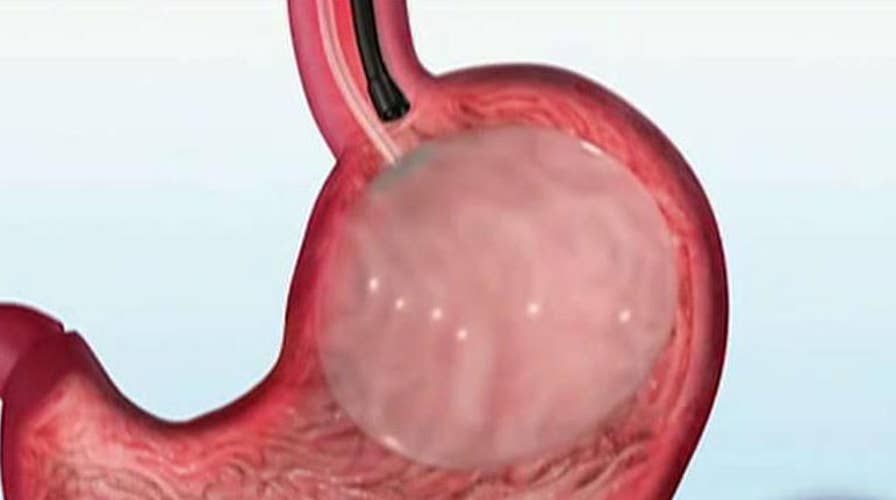 FDA approves non-surgical stomach balloon for weight loss