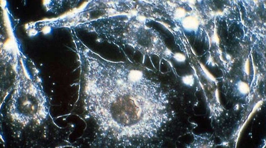 Immunotherapy harnesses the immune system to fight cancer