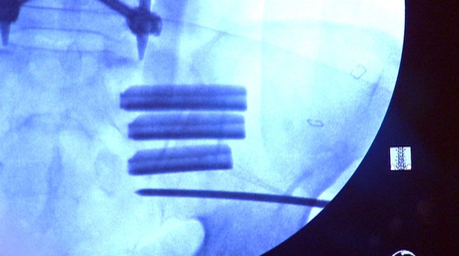 Joint surgery stops veteran’s pain