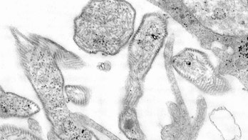 Nebraska sees 'significant' increase in mumps cases amid recent outbreaks